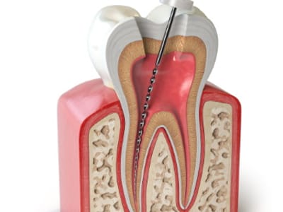 Oral Health Center / Dental care Westerville