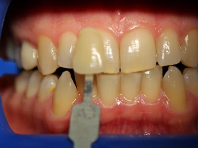 Orange Gentle Dentist