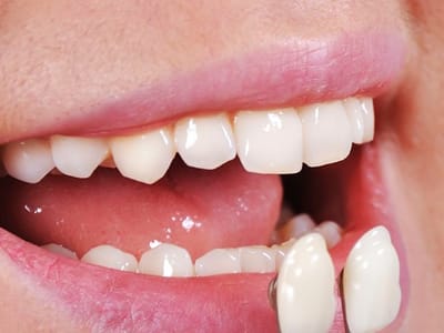 Orchard Meadows Family Dental & Denture Clinic