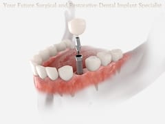 Oregon Dental Implant Residency