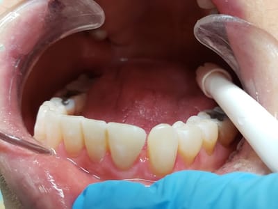 Pacific Ocean Dental Group - Dentist East Los Angeles