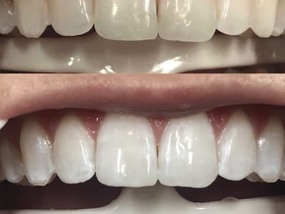 Pacific View Dental Group