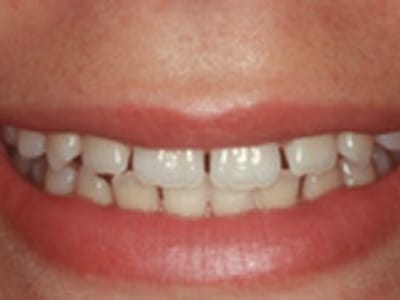 Pear Valley Dental - Medford Location