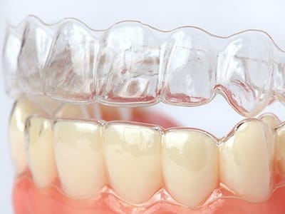 PearlFection Dentistry - Frederick Maryland