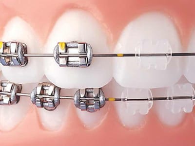 PearlFection Dentistry - Frederick Maryland