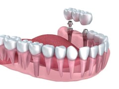 PearlFection Dentistry - Frederick Maryland