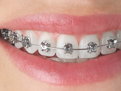 PearlFection Dentistry - Frederick Maryland