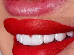 Pearly Smile Dental Studio - Shelby Township Dentist