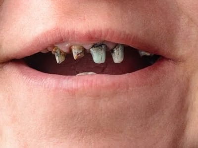 Pediatric Dental Care Associates-Aliante