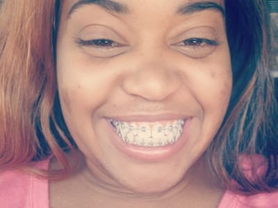 Pediatric Dental Care Associates-Aliante