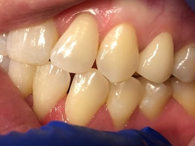 Perfect 32 Family Dentistry