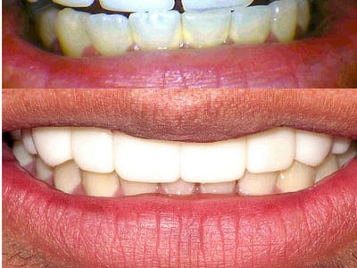 Perfect Smile - Dentist in Tulsa, OK