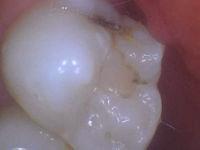 Philson Dental PC - Greg A. Philson, DDS