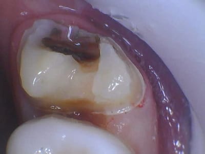 Philson Dental PC - Greg A. Philson, DDS