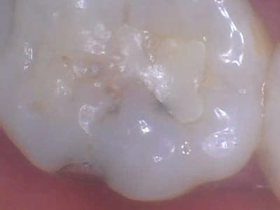 Philson Dental PC - Greg A. Philson, DDS