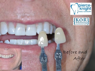 Pierce & Knight Family Dentistry