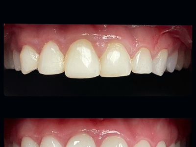 Pineview Dental Care: Dr. Adam J. Myers, DDS