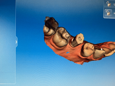 Pitt Family Dentistry