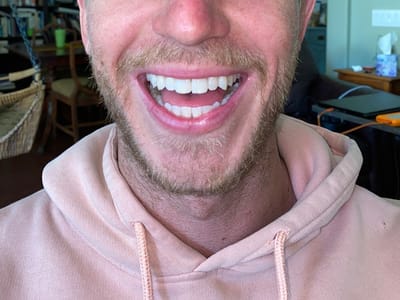 Plaza Dentistry - Dentists in Rancho Bernardo Ca