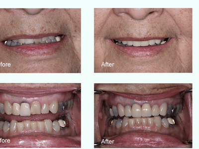 Portneuf Valley Dental