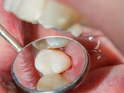 Powers Dental Group - Colorado Springs