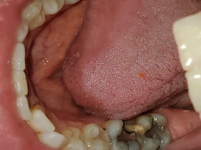 Precision Family Dentistry of Merced - Nathan Miller DDS, Jeremy Skinner DDS