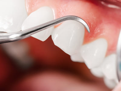 Premier Valley Dental