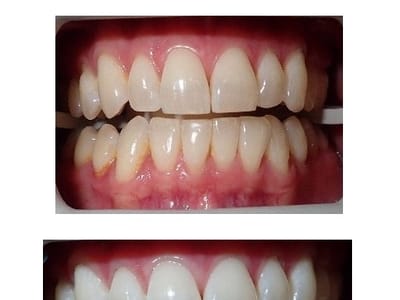 Preston Commons Dental Care