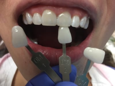 Progressive Dental-Matthew McReynolds