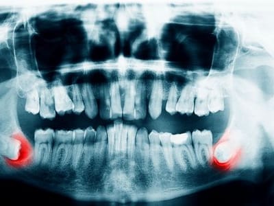 Promenade Center For Dentistry Of Charlotte NC