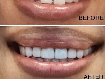 Radiant Smiles- Arlington Family Dentist