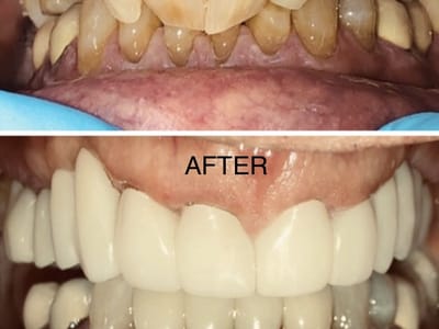 Radiant Smiles- Arlington Family Dentist