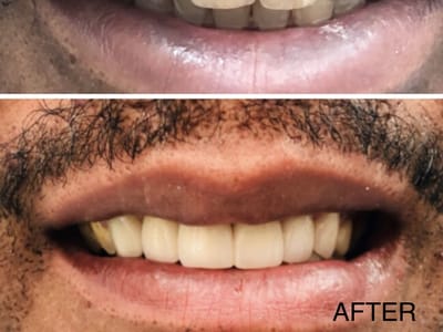 Radiant Smiles- Arlington Family Dentist