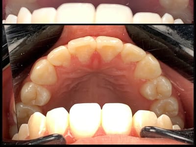 Rapid City Smiles: Implant & Family Dentistry - Dr. Dan Graves DMD