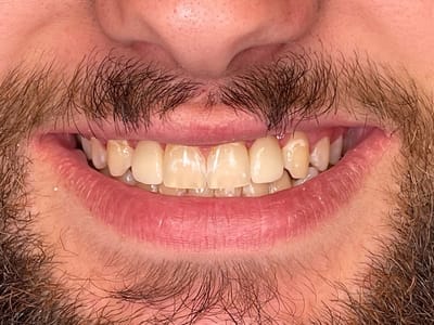 Rapid City Smiles: Implant & Family Dentistry - Dr. Dan Graves DMD