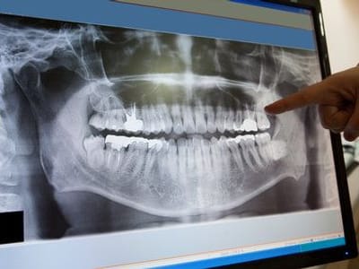 Raymond Cruz Best, DDS