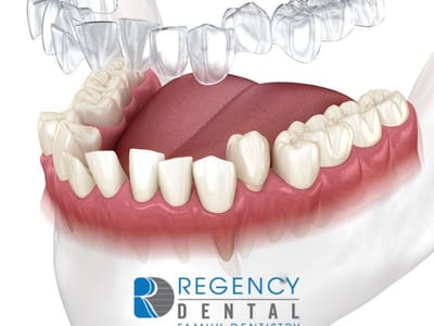 Regency Dental Omaha
