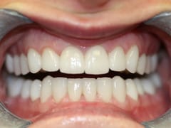Rejuvenation Dentistry