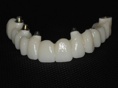 Restorative and Implant Dentistry Pompano Beach