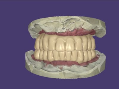 Restorative and Implant Dentistry Pompano Beach