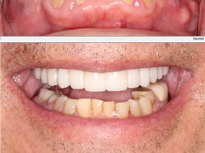 Restorative and Implant Dentistry Pompano Beach