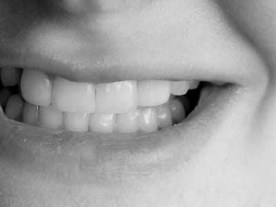 Rice Dental Arts Office Of Dr. Janet H. Rice, DDS