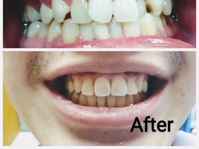 RiteSmile Family and Cosmetic Dentistry-Dentist Sugar Land