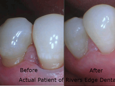Rivers Edge Dental