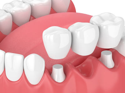 Rogue Valley Dental Center