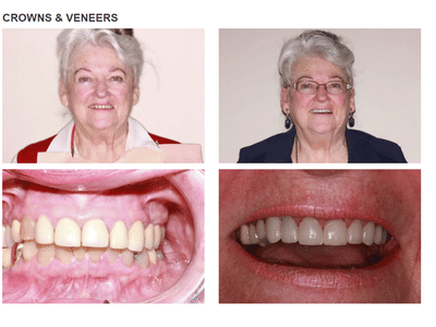 Roy Dental Care - Smile Makeovers and Dental Implants