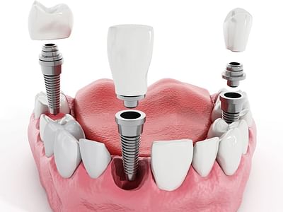 Royal Family Dentistry