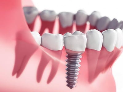 Sahara Dental Center