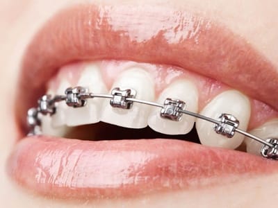 Sahara Dental Center