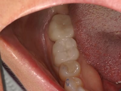 Salem Dentistry: Roxana Salem, DDS